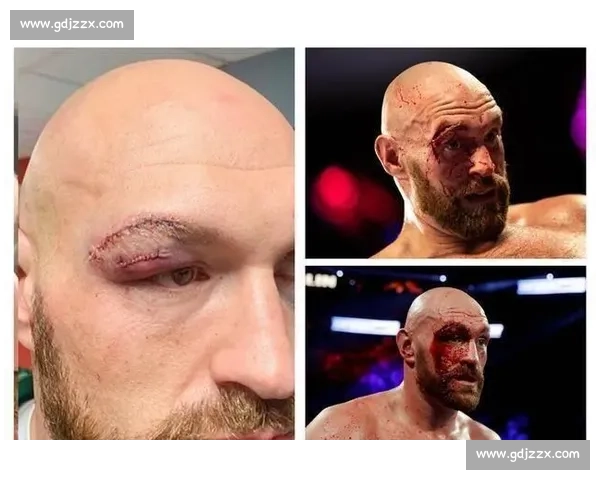 拳坛世纪对决克利钦科对阵泰森力量与技术的终极碰撞谁主沉浮之战